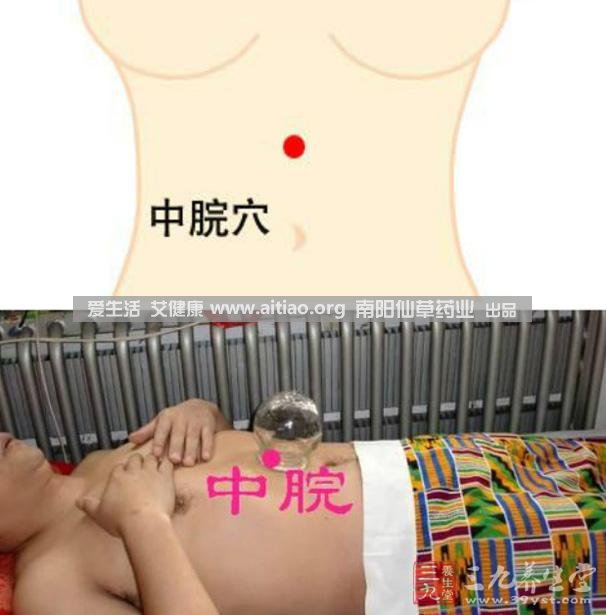 中脘穴位于腹部正中線(xiàn)，臍上4寸的位置上。每天艾灸10-15分鐘，能有效緩解胃部不適的癥狀，同時(shí)有助于祛濕。