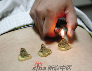 灸法的種類(lèi)  你知道多少？