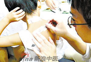 灸法的種類(lèi)  你知道多少？